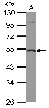 CASP2 / Caspase 2 Antibody - Sample (30 ug of whole cell lysate) A: HepG2 10% SDS PAGE CASP2 / Caspase 2 antibody diluted at 1:2000