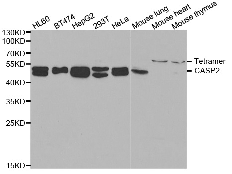 CASP2 / Caspase 2 Antibody - Western blot analysis of extracts of various cell lines.