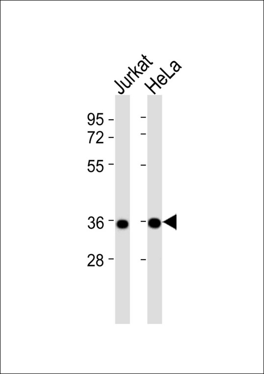 CASP2 / Caspase 2 Antibody - All lanes : Anti-Caspase 2 p18 Antibody at 1:1000 dilution Lane 1: Jurkat whole cell lysates Lane 2: HeLa whole cell lysates Lysates/proteins at 20 ug per lane. Secondary Goat Anti-Rabbit IgG, (H+L),Peroxidase conjugated at 1/10000 dilution Predicted band size : 51 kDa Blocking/Dilution buffer: 5% NFDM/TBST.