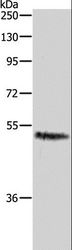 CASP2 / Caspase 2 Antibody - Western blot analysis of HeLa cell, using CASP2 Polyclonal Antibody at dilution of 1:1000.