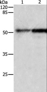 CASP2 / Caspase 2 Antibody - Western blot analysis of Human fetal kidney and lung tissue, using CASP2 Polyclonal Antibody at dilution of 1:950.