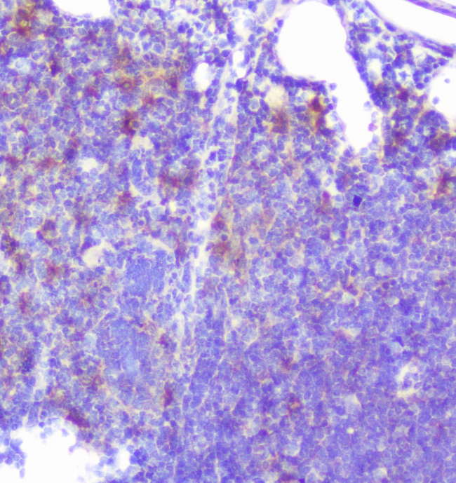 CASP2 / Caspase 2 Antibody - IHC analysis of Caspase-2 using anti-Caspase-2 antibody. Caspase-2 was detected in paraffin-embedded section of mouse intestine tissue. Heat mediated antigen retrieval was performed in citrate buffer (pH6, epitope retrieval solution) for 20 mins. The tissue section was blocked with 10% goat serum. The tissue section was then incubated with 1µg/ml rabbit anti-Caspase-2 Antibody overnight at 4°C. Biotinylated goat anti-rabbit IgG was used as secondary antibody and incubated for 30 minutes at 37°C. The tissue section was developed using Strepavidin-Biotin-Complex (SABC) with DAB as the chromogen.