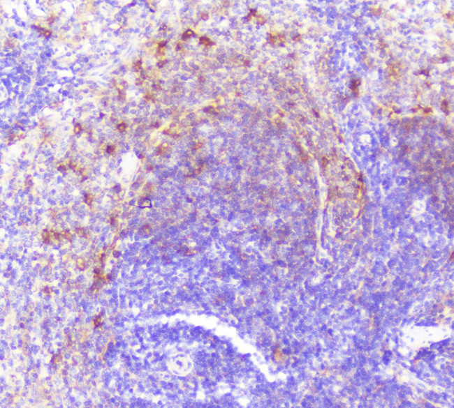 CASP2 / Caspase 2 Antibody - IHC analysis of Caspase-2 using anti-Caspase-2 antibody. Caspase-2 was detected in paraffin-embedded section of rat spleen tissue. Heat mediated antigen retrieval was performed in citrate buffer (pH6, epitope retrieval solution) for 20 mins. The tissue section was blocked with 10% goat serum. The tissue section was then incubated with 1µg/ml rabbit anti-Caspase-2 Antibody overnight at 4°C. Biotinylated goat anti-rabbit IgG was used as secondary antibody and incubated for 30 minutes at 37°C. The tissue section was developed using Strepavidin-Biotin-Complex (SABC) with DAB as the chromogen.