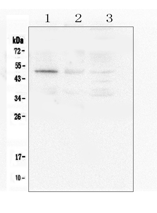 CASP2 / Caspase 2 Antibody - Western blot analysis of Caspase-2 using anti-Caspase-2 antibody. Electrophoresis was performed on a 5-20% SDS-PAGE gel at 70V (Stacking gel) / 90V (Resolving gel) for 2-3 hours. The sample well of each lane was loaded with 50ug of sample under reducing conditions. Lane 1: human PANC-1 whole cell lysate,Lane 2: human 22RV1 whole cell lysate,Lane 3: human SGC-7901 whole cell lysate. After Electrophoresis, proteins were transferred to a Nitrocellulose membrane at 150mA for 50-90 minutes. Blocked the membrane with 5% Non-fat Milk/ TBS for 1.5 hour at RT. The membrane was incubated with rabbit anti-Caspase-2 antigen affinity purified polyclonal antibody at 0.5 µg/mL overnight at 4°C, then washed with TBS-0.1% Tween 3 times with 5 minutes each and probed with a goat anti-rabbit IgG-HRP secondary antibody at a dilution of 1:10000 for 1.5 hour at RT. The signal is developed using an Enhanced Chemiluminescent detection (ECL) kit with Tanon 5200 system. A specific band was detected for Caspase-2 at approximately 51KD. The expected band size for Caspase-2 is at 51KD.
