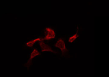 CASP2 / Caspase 2 Antibody - Staining HepG2 cells by IF/ICC. The samples were fixed with PFA and permeabilized in 0.1% Triton X-100, then blocked in 10% serum for 45 min at 25°C. The primary antibody was diluted at 1:200 and incubated with the sample for 1 hour at 37°C. An Alexa Fluor 594 conjugated goat anti-rabbit IgG (H+L) Ab, diluted at 1/600, was used as the secondary antibody.