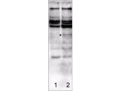 CASP2 / Caspase 2 Antibody - Anti-Caspase-2 Antibody - Western Blot. Affinity Purified antibody to Caspase-2 was used at a 1:750 dilution to detect rat caspase-2 in transfected human 292 cell lysates by Western blot. Asterisk indicates a 48 kD caspase-2 protein clearly detected in the rat caspase-2 transfected lysate. No reaction is observed against human caspase-2. Control (lane 1) and transfected (lane 2) lysates were loaded on a 4-20% gel for SDS-PAGE. After primary antibody incubation and washing, a 1:5000 dilution of HRP conjugated Gt-a-Rabbit IgG (LS-C60865) preceded color development using Amershams substrate system. Other detection methods will yield similar results.