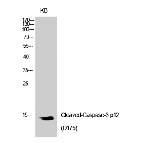 CASP3 / Caspase 3 Antibody - Western blot of Cleaved-Caspase-3 p12 (D175) antibody
