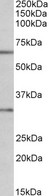 CASP3 / Caspase 3 Antibody - CASP3 antibody (1 ug/ml) staining of MOLT4 lysate (35 ug protein in RIPA buffer). Primary incubation was 1 hour. Detected by chemiluminescence.