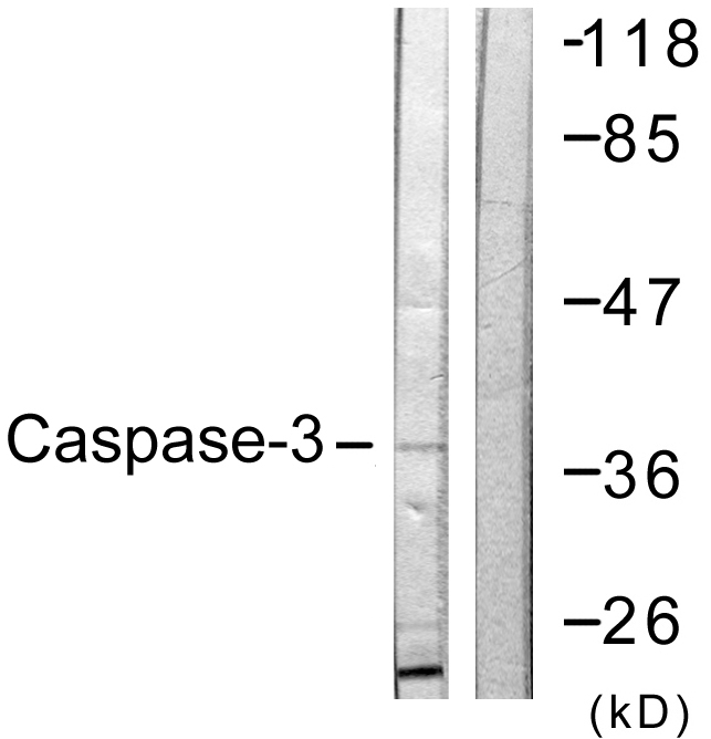 CASP3 / Caspase 3 Antibody - Western blot analysis of lysates from NIH/3T3 cells, treated with Etoposide 25uM 24h, using Caspase 3 Antibody. The lane on the right is blocked with the synthesized peptide.