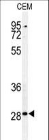 CASP3 / Caspase 3 Antibody - Western blot of CASP3 (Asp175) Antibody in CEM cell line lysates (35 ug/lane). CASP3 (arrow) was detected using the purified antibody.