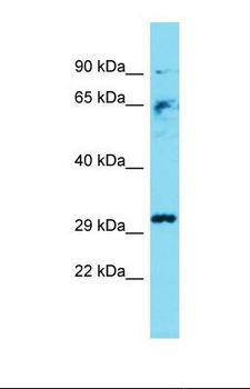 CASP3 / Caspase 3 Antibody - Western blot of Mouse Liver. Casp3 antibody dilution 1.0 ug/ml.  This image was taken for the unconjugated form of this product. Other forms have not been tested.