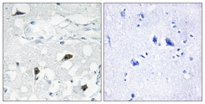 CASP3 / Caspase 3 Antibody - IHC of paraffin-embedded human brain tissue, using Caspase 3 (Cleaved-Asp175) Antibody. The sample on the right was incubated with synthetic peptide.