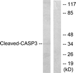 CASP3 / Caspase 3 Antibody - Western blot of extracts from HeLa cells, treated with Etoposide 25uM 60', using Caspase 3 (Cleaved-Asp175) Antibody. The lane on the right was incubated with synthetic peptide.