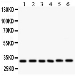 CASP3 / Caspase 3 Antibody - Western blot - Anti-Caspase 3 Antibody