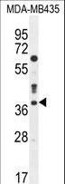 CASP3 / Caspase 3 Antibody - CASP3 Antibody western blot of MDA-MB435 cell line lysates (35 ug/lane). The CASP3 antibody detected the CASP3 protein (arrow).