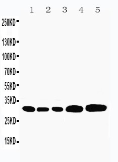 CASP3 / Caspase 3 Antibody - Caspase-3(P10) antibody Western blot. Lane 1: Rat Liver Tissue Lysate. Lane 2: Rat Thymus Tissue Lysate. Lane 3: Rat Spleen Tissue Lysate. Lane 4: HEPA Cell Lysate. Lane 5: NEURO Cell Lysate.