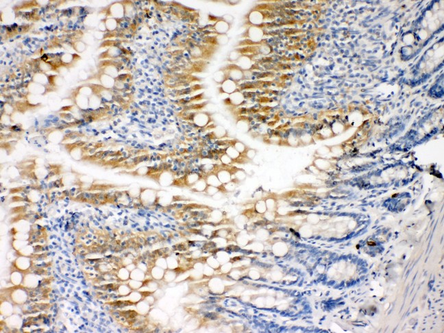 CASP3 / Caspase 3 Antibody - Caspase-3(P10) antibody IHC-paraffin: Rat Intestine Tissue.