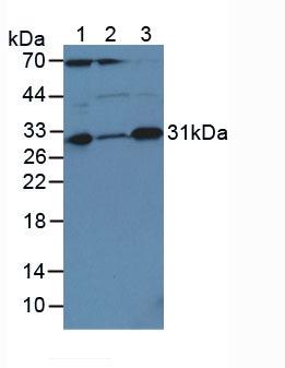 CASP3 / Caspase 3 Antibody - Western Blot; Sample: Lane1: Human Liver Tissue; Lane2: Human Jurkat Cells; Lane3: Human Hela Cells.