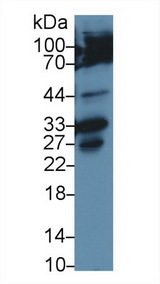 CASP3 / Caspase 3 Antibody - Western Blot; Sample: Human Hela cell lysate; Primary Ab: 2µg/ml Rabbit Anti-Rat CASP3 Antibody Second Ab: 0.2µg/mL HRP-Linked Caprine Anti-Rabbit IgG Polyclonal Antibody