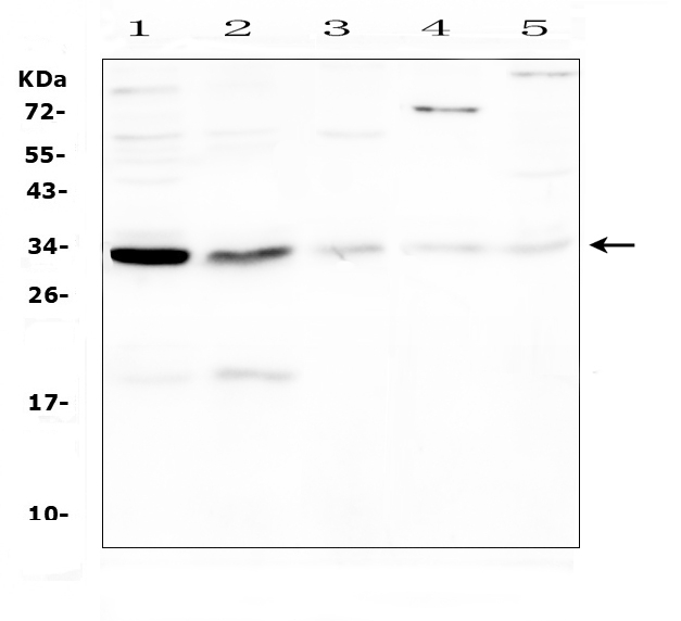 CASP3 / Caspase 3 Antibody - Western blot analysis of Caspase-3 (P17) using anti-Caspase-3 (P17) antibody. Electrophoresis was performed on a 5-20% SDS-PAGE gel at 70V (Stacking gel) / 90V (Resolving gel) for 2-3 hours. The sample well of each lane was loaded with 50ug of sample under reducing conditions. Lane 1: mouse thymus tissue lysates, Lane 2: mouse spleen tissue lysates, Lane 3: mouse lung tissue lysates, Lane 4: mouse brain tissue lysates,Lane 5: mouse testis tissue lysates. After Electrophoresis, proteins were transferred to a Nitrocellulose membrane at 150mA for 50-90 minutes. Blocked the membrane with 5% Non-fat Milk/ TBS for 1.5 hour at RT. The membrane was incubated with rabbit anti-Caspase-3 (P17) antigen affinity purified polyclonal antibody at 0.5 µg/mL overnight at 4°C, then washed with TBS-0.1% Tween 3 times with 5 minutes each and probed with a goat anti-rabbit IgG-HRP secondary antibody at a dilution of 1:10000 for 1.5 hour at RT. The signal is developed using an Enhanced Chemiluminescent detection (ECL) kit with Tanon 5200 system. A specific band was detected for Caspase-3 (P17) at approximately 32KD,19KD. The expected band size for Caspase-3 (P17) is at 32KD,17KD.