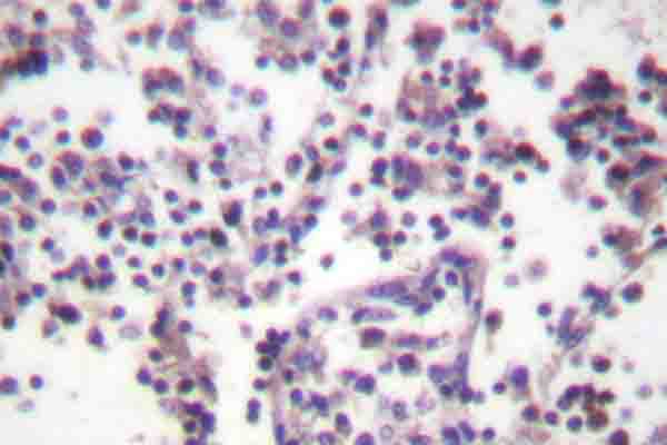 CASP3 / Caspase 3 Antibody - IHC of Caspase 3 (D146) pAb in paraffin-embedded human lymph node tissue.