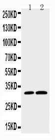 CASP3 / Caspase 3 Antibody - WB of CASP3 / Caspase 3 antibody. All lanes: Anti-CASP3(P10) at 0.5ug/ml. Lane 1: HELA Whole Cell Lysate at 40ug. Lane 2: SMMC Whole Cell Lysate at 40ug. Predicted bind size: 31KD. Observed bind size: 31KD.