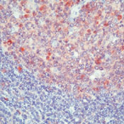 CASP3 / Caspase 3 Antibody - Formalin-fixed, paraffin-embedded human tonsil stained with peroxidase-conjugate and AEC chromogen. Note cytoplasmic and nuclear staining of lymphoid cells.  This image was taken for the unmodified form of this product. Other forms have not been tested.