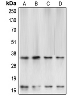 CASP3 / Caspase 3 Antibody - Western blot analysis of Caspase 3 expression in HeLa (A); SP2/0 (B); Raw264.7 (C); rat brain (D) whole cell lysates.