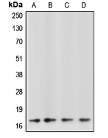 CASP3 / Caspase 3 Antibody - Western blot analysis of Caspase 3 p17 expression in SP2/0 (A); Jurkat etoposide-treated (B); NIH3T3 staurosporine-treated (C); HeLa (D) whole cell lysates.