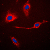 CASP3 / Caspase 3 Antibody - Immunofluorescent analysis of Caspase 3 p17 staining in Jurkat cells. Formalin-fixed cells were permeabilized with 0.1% Triton X-100 in TBS for 5-10 minutes and blocked with 3% BSA-PBS for 30 minutes at room temperature. Cells were probed with the primary antibody in 3% BSA-PBS and incubated overnight at 4 C in a humidified chamber. Cells were washed with PBST and incubated with a DyLight 594-conjugated secondary antibody (red) in PBS at room temperature in the dark. DAPI was used to stain the cell nuclei (blue).