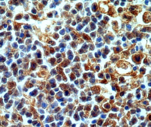 CASP3 / Caspase 3 Antibody - Immunohistochemistry (IHC) analysis of Caspase-3 pAb in paraffin-embedded H-spleen tissue.