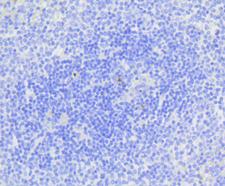 CASP3 / Caspase 3 Antibody - Immunohistochemistry of paraffin-embedded human spleen using CASP3 antibodyat dilution of 1:100 (40x lens).