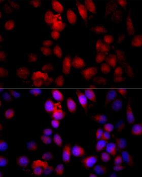 CASP3 / Caspase 3 Antibody - Immunofluorescence analysis of HeLa cells using CASP3 antibody at dilution of 1:100 (40x lens). Blue: DAPI for nuclear staining.