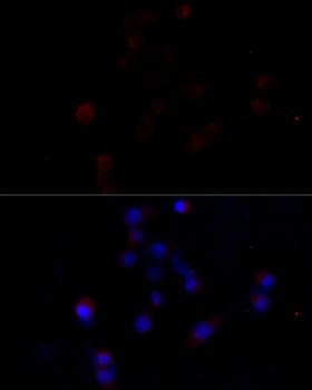 CASP3 / Caspase 3 Antibody - Immunofluorescence analysis of NIH/3T3 cells using CASP3 antibody at dilution of 1:100 (40x lens). Blue: DAPI for nuclear staining.