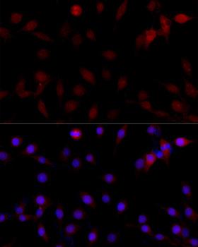 CASP3 / Caspase 3 Antibody - Immunofluorescence analysis of PC-12 cells using CASP3 antibody at dilution of 1:100 (40x lens). Blue: DAPI for nuclear staining.