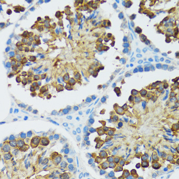 CASP3 / Caspase 3 Antibody - Immunohistochemistry of paraffin-embedded rat testis using CASP3 antibody at dilution of 1:100 (40x lens).