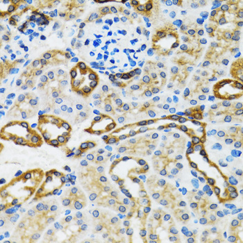 CASP3 / Caspase 3 Antibody - Immunohistochemistry of paraffin-embedded rat kidney using CASP3 antibody at dilution of 1:100 (40x lens).