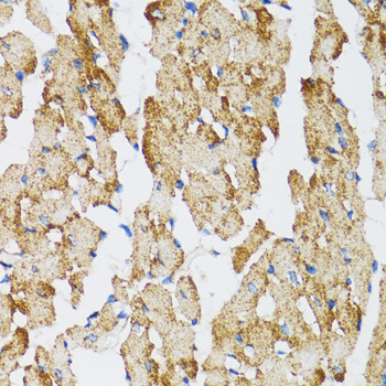 CASP3 / Caspase 3 Antibody - Immunohistochemistry of paraffin-embedded mouse heart using CASP3 antibody at dilution of 1:100 (40x lens).