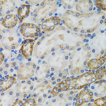 CASP3 / Caspase 3 Antibody - Immunohistochemistry of paraffin-embedded mouse kidney using CASP3 antibody at dilution of 1:100 (40x lens).