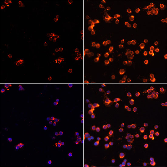 CASP3 / Caspase 3 Antibody - Immunofluorescence analysis of Jurkat cells using CASP3 antibody at dilution of 1:100. Jurkat cells treated by Etoposide 25uM etoposide for 5 hours (left). Blue: DAPI for nuclear staining.