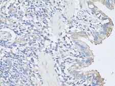CASP3 / Caspase 3 Antibody - Immunohistochemistry of paraffin-embedded rat lung using CASP3 antibody at dilution of 1:100 (40x lens).