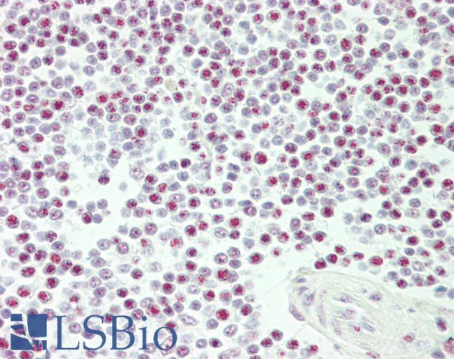 CASP3 / Caspase 3 Antibody - Human Spleen: Formalin-Fixed, Paraffin-Embedded (FFPE)