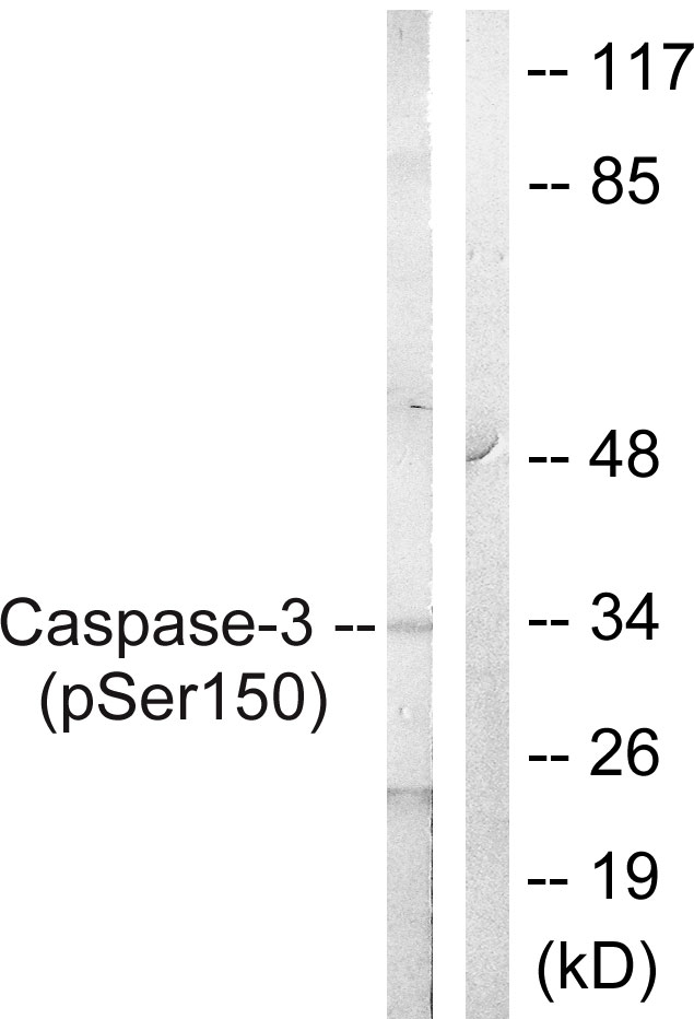 CASP3 / Caspase 3 Antibody - Western blot analysis of lysates from Jurkat cells treated with Etoposide 25uM 60', using Caspase 3 (Phospho-Ser150) Antibody. The lane on the right is blocked with the phospho peptide.