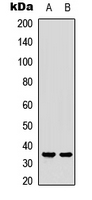CASP3 / Caspase 3 Antibody - Western blot analysis of Caspase 3 (pS150) expression in HCT116 (A); Jurkat (B) whole cell lysates.
