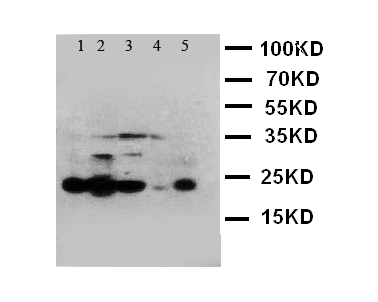 CASP4 / Caspase 4 Antibody - WB of CASP4 / Caspase 4 antibody. Lane 1: MCF-7 Cell Lysate. Lane 2: HELA Cell Lysate. Lane 3: JURKAT Cell Lysate . Lane 4: CEM Cell Lysate . Lane 5: SW620 Cell Lysate.