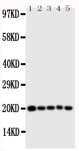CASP4 / Caspase 4 Antibody - Anti-Caspase 4 antibody, Western blotting All lanes: Anti Caspase 4 at 0.5ug/ml Lane 1: MCF-7 Whole Cell Lysate at 40ug Lane 2: HELA Whole Cell Lysate at 40ug Lane 3: JURKAT Whole Cell Lysate at 40ug Lane 4: CEM Whole Cell Lysate at 40ug Lane 5: SW620 Whole Cell Lysate at 40ug Predicted bind size: 43KD Observed bind size: 20KD