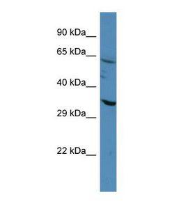 CASP4 / Caspase 4 Antibody - Western blot of Human A549. CASP4 antibody dilution 1.0 ug/ml.  This image was taken for the unconjugated form of this product. Other forms have not been tested.