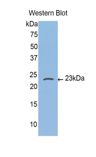 CASP4 / Caspase 4 Antibody - Western blot of recombinant CASP4 / Caspase 4.  This image was taken for the unconjugated form of this product. Other forms have not been tested.