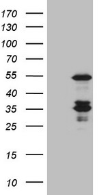 CASP4 / Caspase 4 Antibody - HEK293T cells were transfected with the pCMV6-ENTRY control. (Left lane) or pCMV6-ENTRY CASP4. (Right lane) cDNA for 48 hrs and lysed. Equivalent amounts of cell lysates. (5 ug per lane) were separated by SDS-PAGE and immunoblotted with anti-CASP4. (1:2000)