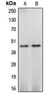 CASP4 / Caspase 4 Antibody - Western blot analysis of Caspase 4 expression in Ramos (A); HEK293 (B) whole cell lysates.